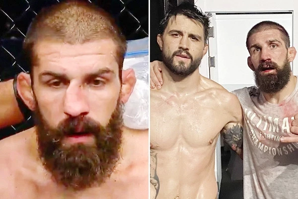 «Гребаный дикарь». Боец MMA вправил нос во время боя
